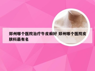 郑州哪个医院治疗牛皮癣好 郑州哪个医院皮肤科最有名