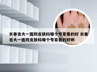 长春吉大一医院皮肤科哪个专家看的好 长春吉大一医院皮肤科哪个专家看的好啊