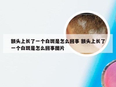 额头上长了一个白斑是怎么回事 额头上长了一个白斑是怎么回事图片