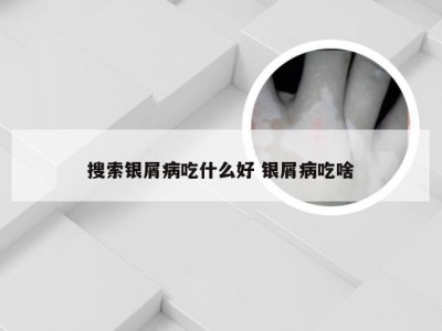 搜索银屑病吃什么好 银屑病吃啥