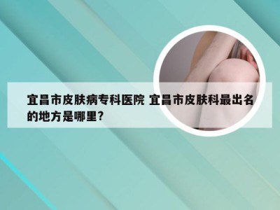 宜昌市皮肤病专科医院 宜昌市皮肤科最出名的地方是哪里?