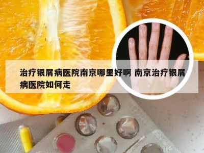 治疗银屑病医院南京哪里好啊 南京治疗银屑病医院如何走