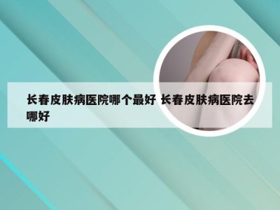 长春皮肤病医院哪个最好 长春皮肤病医院去哪好