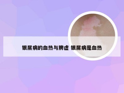 银屑病的血热与脾虚 银屑病是血热