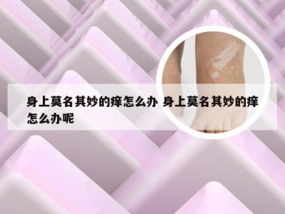 身上莫名其妙的痒怎么办 身上莫名其妙的痒怎么办呢