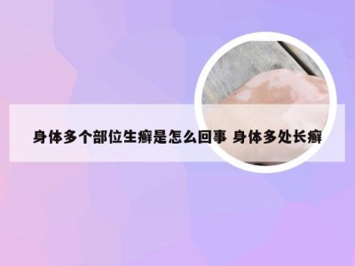 身体多个部位生癣是怎么回事 身体多处长癣