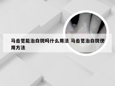 马齿苋能治白斑吗什么用法 马齿苋治白斑使用方法