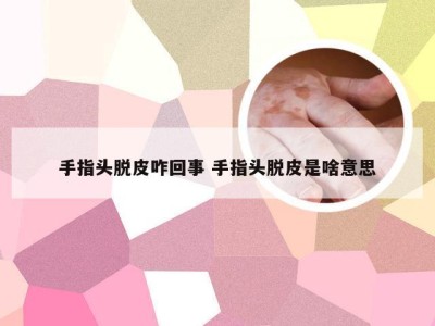 手指头脱皮咋回事 手指头脱皮是啥意思