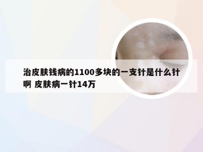 治皮肤钱病的1100多块的一支针是什么针啊 皮肤病一针14万