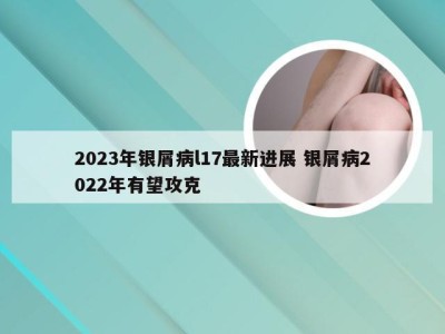 2023年银屑病l17最新进展 银屑病2022年有望攻克