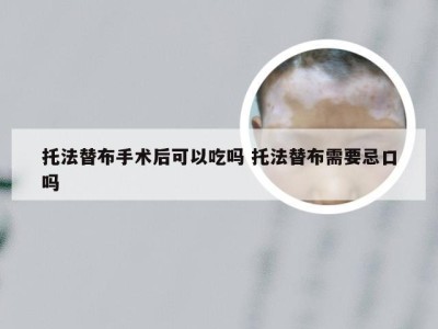 托法替布手术后可以吃吗 托法替布需要忌口吗