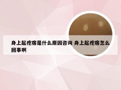 身上起疙瘩是什么原因咨询 身上起疙瘩怎么回事啊