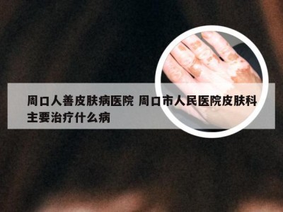 周口人善皮肤病医院 周口市人民医院皮肤科主要治疗什么病