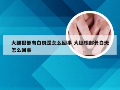 大腿根部有白斑是怎么回事 大腿根部长白斑怎么回事