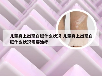 儿童身上出现白斑什么状况 儿童身上出现白斑什么状况需要治疗