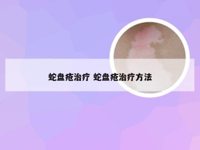 蛇盘疮治疗 蛇盘疮治疗方法