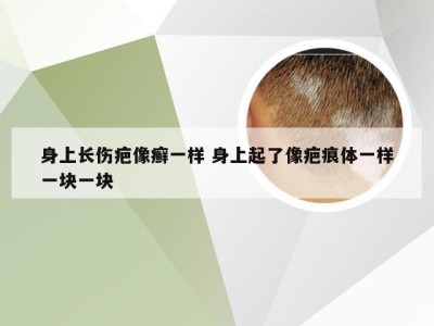 身上长伤疤像癣一样 身上起了像疤痕体一样一块一块