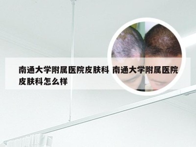 南通大学附属医院皮肤科 南通大学附属医院皮肤科怎么样