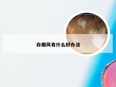 白癜风有什么好办法