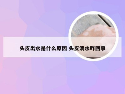 头皮出水是什么原因 头皮淌水咋回事