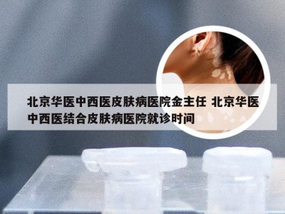 北京华医中西医皮肤病医院金主任 北京华医中西医结合皮肤病医院就诊时间