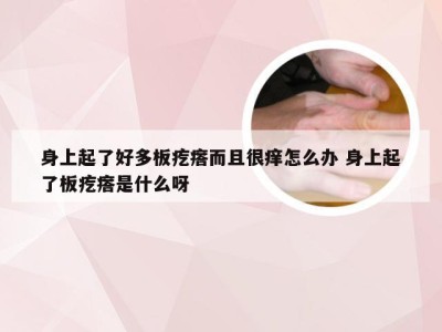 身上起了好多板疙瘩而且很痒怎么办 身上起了板疙瘩是什么呀