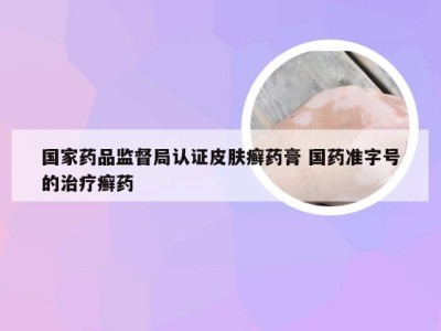 国家药品监督局认证皮肤癣药膏 国药准字号的治疗癣药