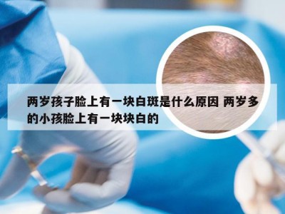 两岁孩子脸上有一块白斑是什么原因 两岁多的小孩脸上有一块块白的