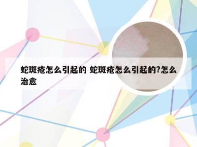 蛇斑疮怎么引起的 蛇斑疮怎么引起的?怎么治愈