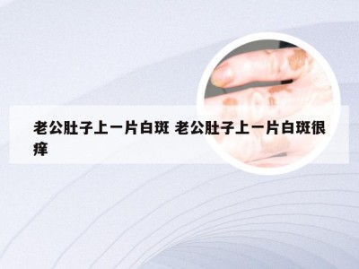 老公肚子上一片白斑 老公肚子上一片白斑很痒