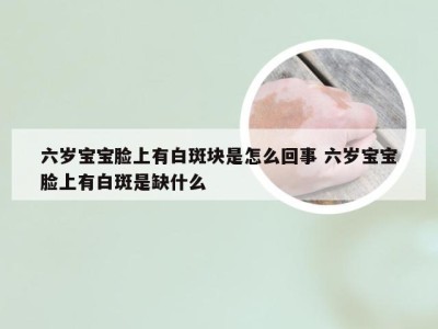 六岁宝宝脸上有白斑块是怎么回事 六岁宝宝脸上有白斑是缺什么