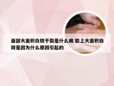 面部大面积白斑干裂是什么病 脸上大面积白斑是因为什么原因引起的