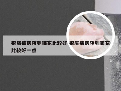 银屑病医院到哪家比较好 银屑病医院到哪家比较好一点