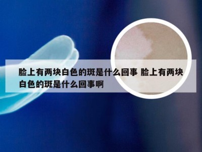 脸上有两块白色的斑是什么回事 脸上有两块白色的斑是什么回事啊