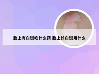 脸上有白斑吃什么药 脸上长白斑用什么