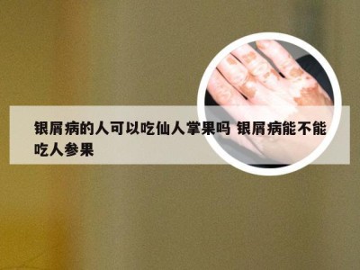 银屑病的人可以吃仙人掌果吗 银屑病能不能吃人参果