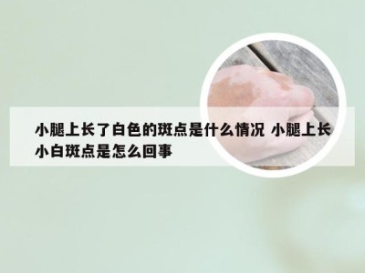 小腿上长了白色的斑点是什么情况 小腿上长小白斑点是怎么回事