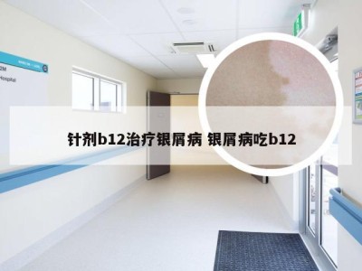 针剂b12治疗银屑病 银屑病吃b12