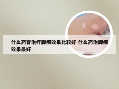 什么药膏治疗脚癣效果比较好 什么药治脚癣效果最好