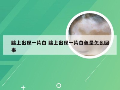 脸上出现一片白 脸上出现一片白色是怎么回事