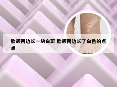 脸颊两边长一块白斑 脸颊两边长了白色的点点