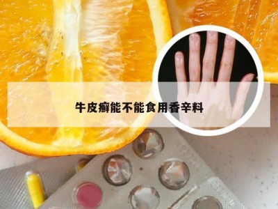 牛皮癣能不能食用香辛料