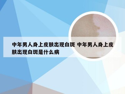 中年男人身上皮肤出现白斑 中年男人身上皮肤出现白斑是什么病