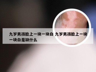 九岁男孩脸上一块一块白 九岁男孩脸上一块一块白是缺什么