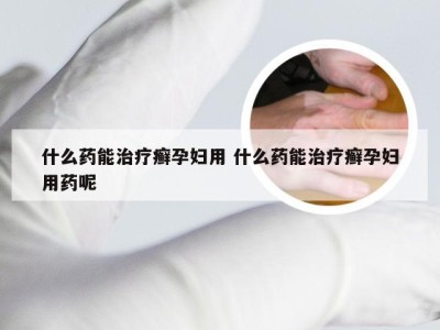 什么药能治疗癣孕妇用 什么药能治疗癣孕妇用药呢