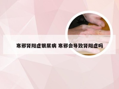 寒邪肾阳虚银屑病 寒邪会导致肾阳虚吗