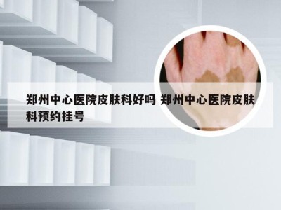 郑州中心医院皮肤科好吗 郑州中心医院皮肤科预约挂号