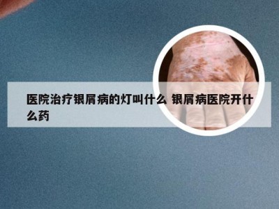 医院治疗银屑病的灯叫什么 银屑病医院开什么药