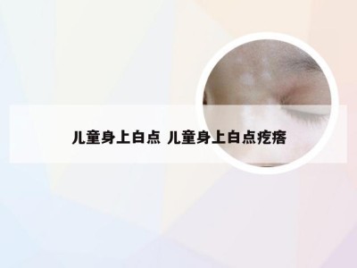 儿童身上白点 儿童身上白点疙瘩