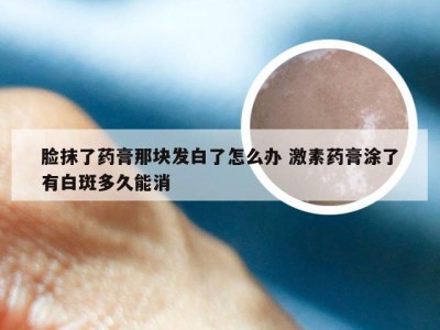 脸抹了药膏那块发白了怎么办 激素药膏涂了有白斑多久能消